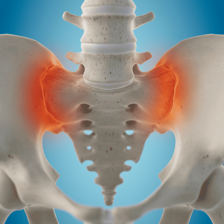 Sacroiliac Joint Dysfunction Chiropractors